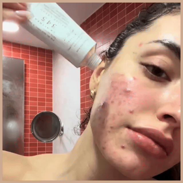 345 RELIEF CREAM 50ML - DR.ALTHEA