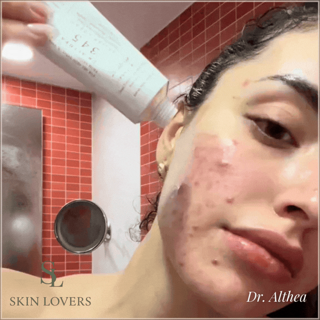 345 RELIEF CREAM 50ML - DR.ALTHEA