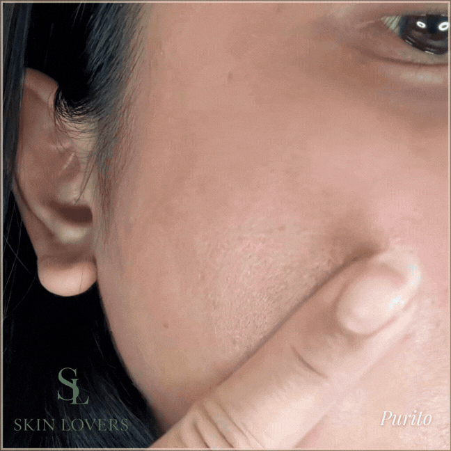 KIT GLOW TOTAL