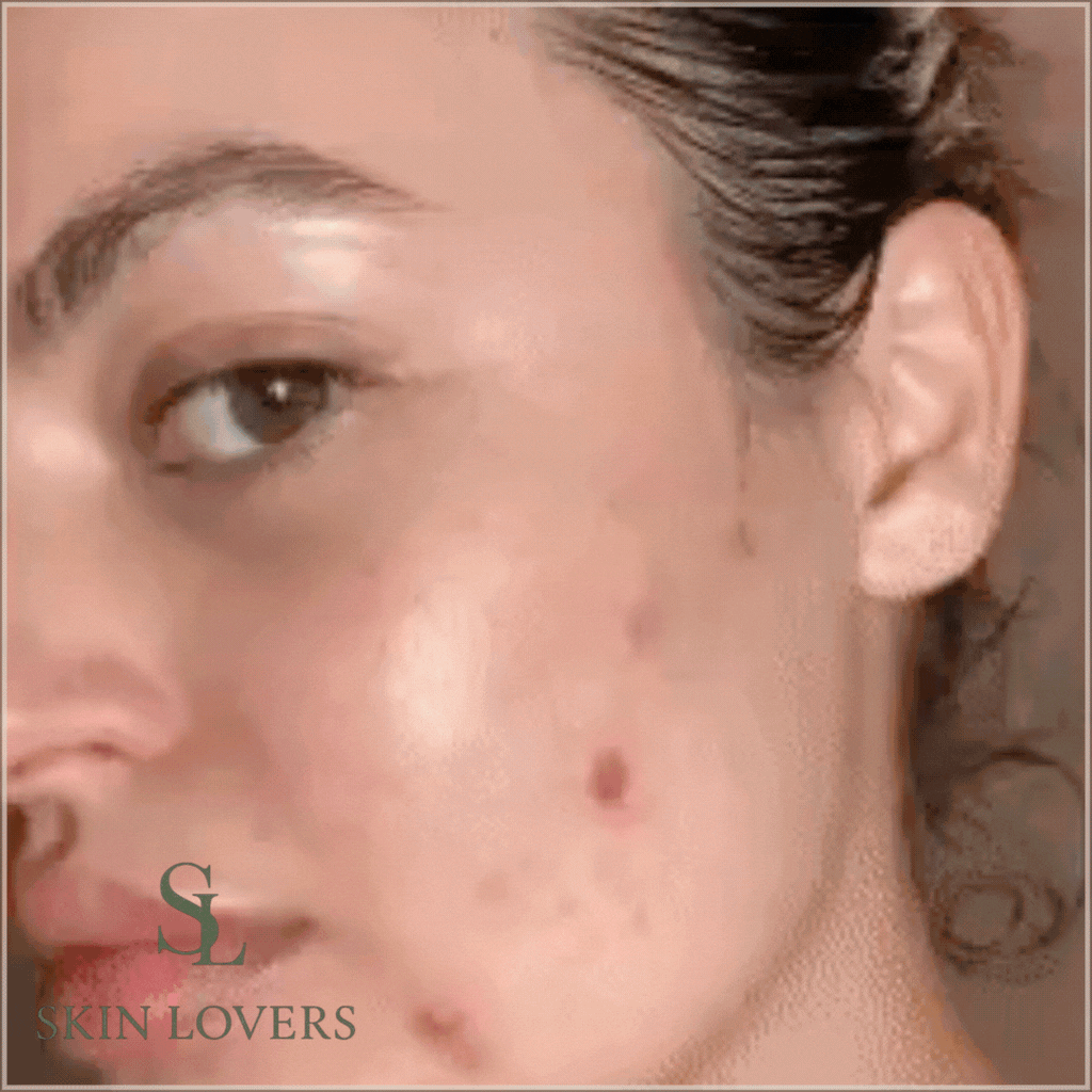 6 IN 1 LED AND MICROCURRENT SKIN REJUVENATION BEAUTY DEVICE - GENERIC