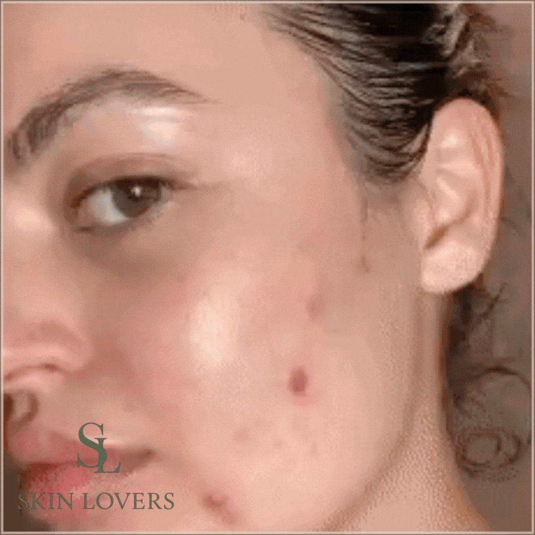 6 IN 1 LED AND MICROCURRENT SKIN REJUVENATION BEAUTY DEVICE - GENERIC
