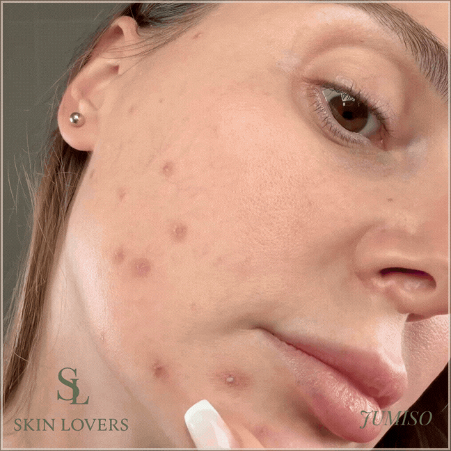NIACINAMIDE 20 SERUM 40ML- JUMISO