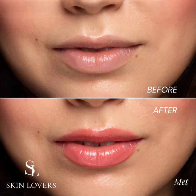 JUICE FOR MY LIPS BRILLO DE LABIOS - MET